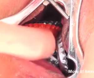 elle est un masochiste hardcore. elle s’arrête de bouchons dans son soutiengorge et les stocke dans ses seins. elle met les couronnes sur sa chatte et les stocke dans sa peau. mais que les bouchons couronne dans sa chatte doit être complètement bless